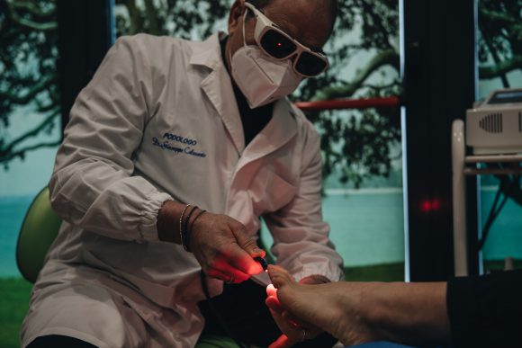 Verruche ai piedi - Come curarle